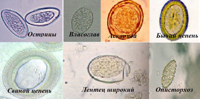 Под микроскопом. Фантастический микромир