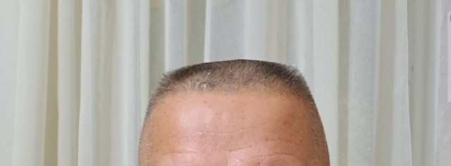 Стрижка головы, у девочек знаю другое.