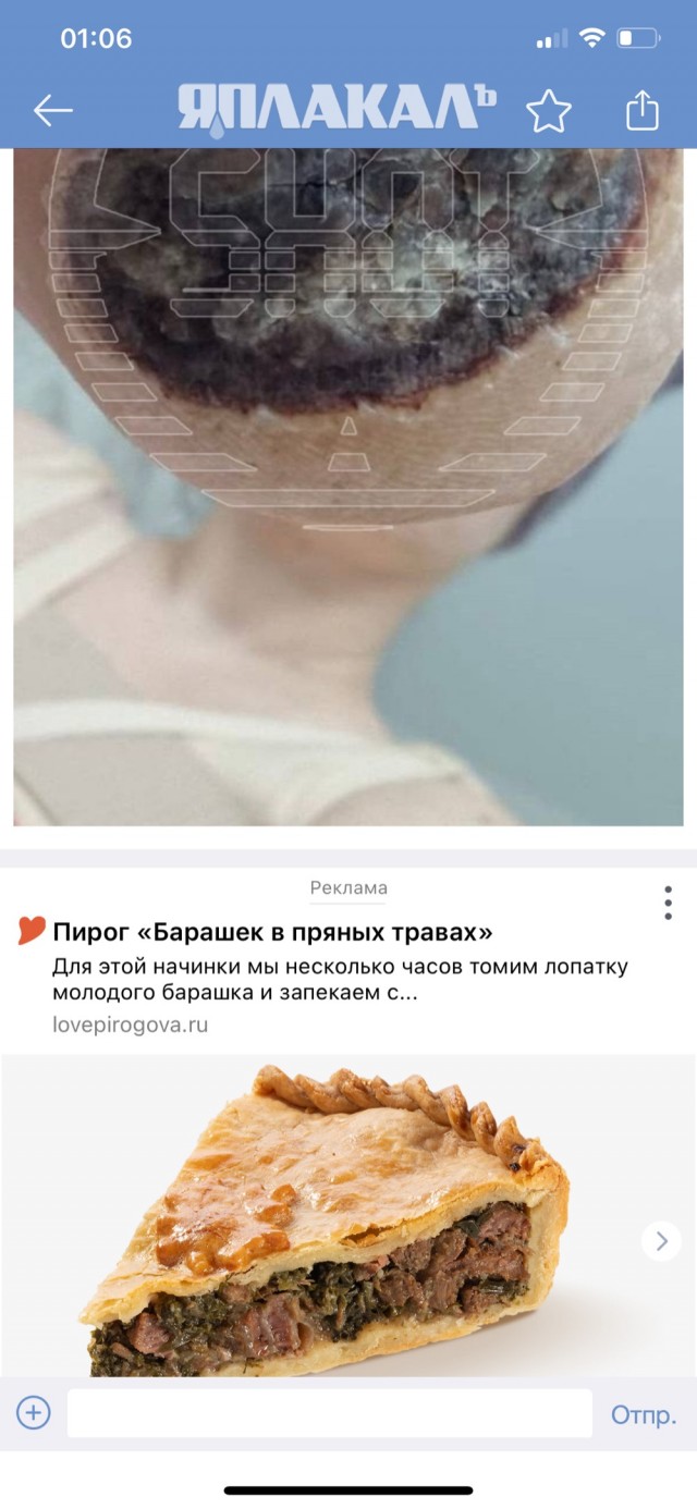 У москвички сгнила пятка после операции по увеличению груди. Ей грозила ампутация стопы