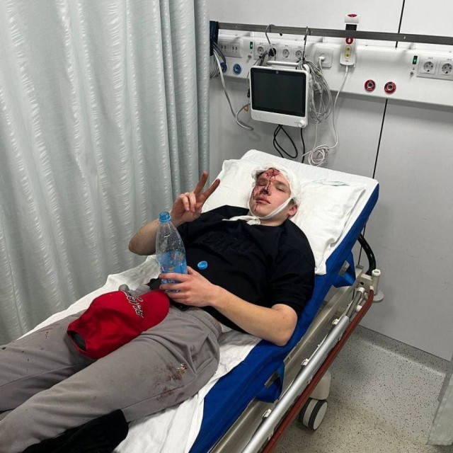 Участники этнической ОПГ жестоко избили и ограбили хоккеиста в Петербурге. Парню выстрелили в лицо из сигнальной ракетницы