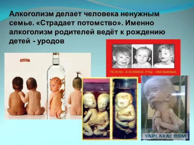В Уфе будут судить врачей, стерилизовавших девочку-инвалида без ее ведома
