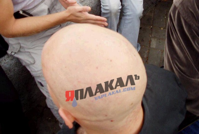 Фотожаба: лысая бошка