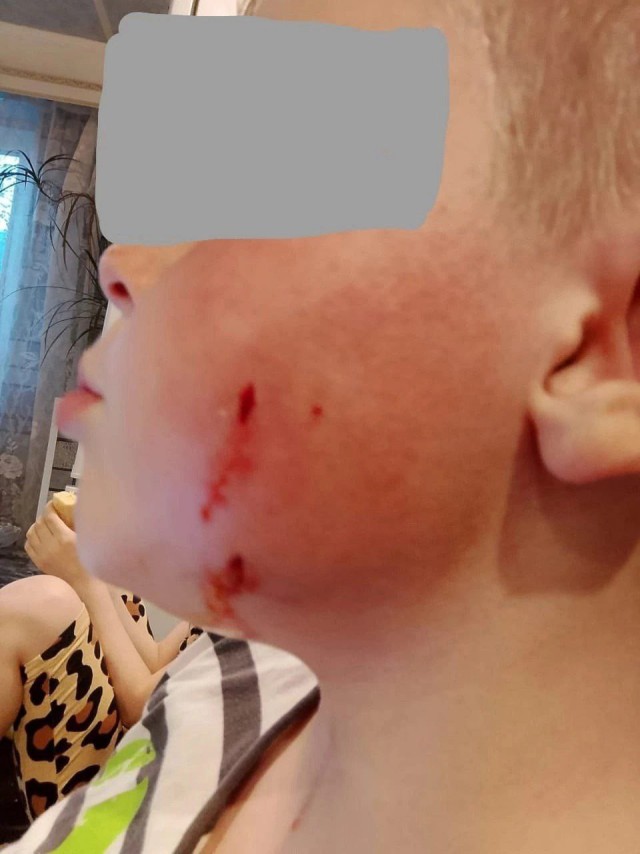 «Ещё чуть-чуть, и она прокусила бы сыну артерию».