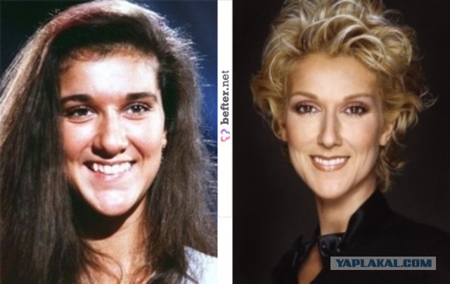 Знаменитости, которые безобразно стареют