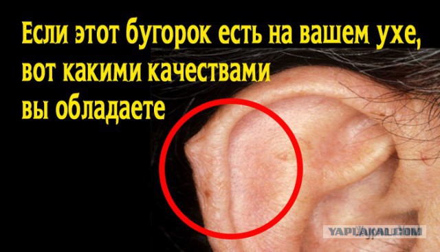 11 неожиданных признаков того, что вы обладаете уникальным телом
