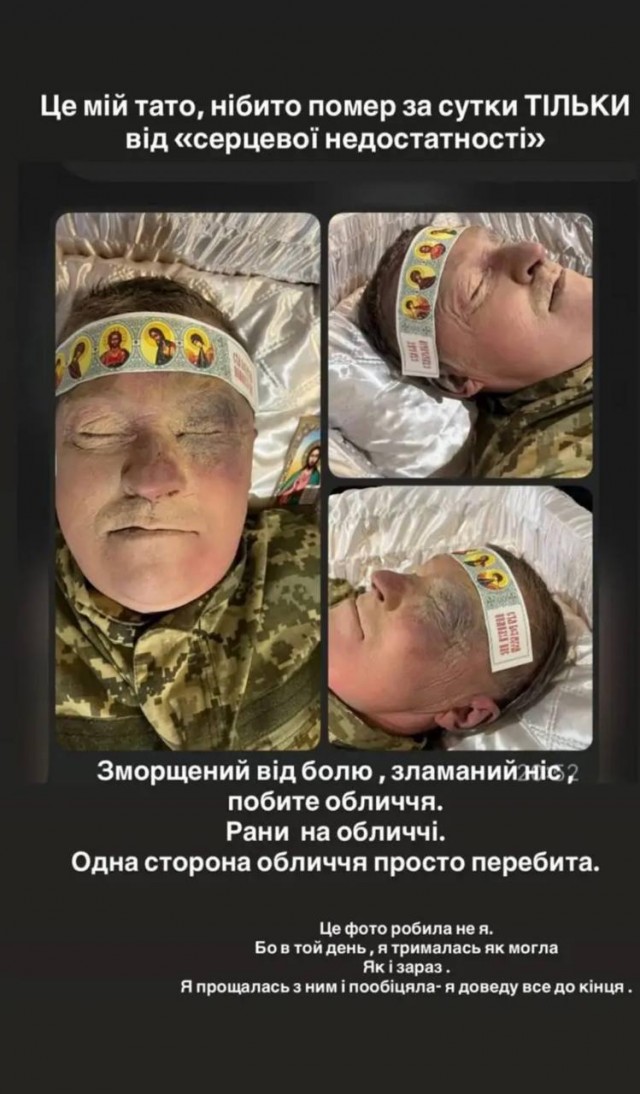 Зеленский: Мы обсудили ситуацию на линии фронта. Я сказал Трампу, что Путин блефует.