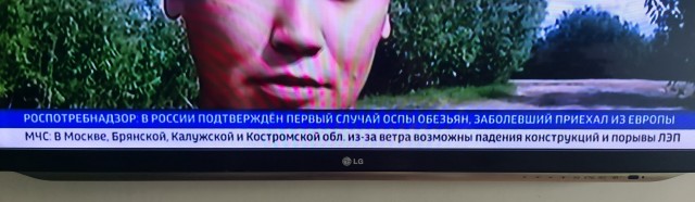 Первый случай заражения оспой обезьян подтвержден в России