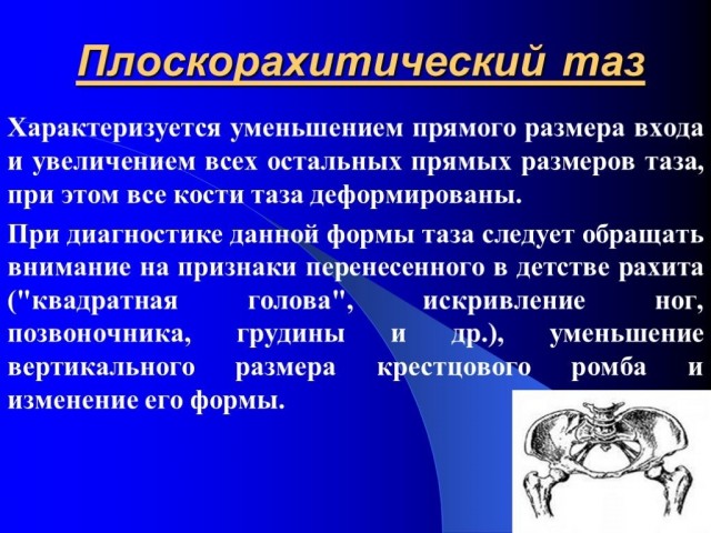 Развал-схождение
