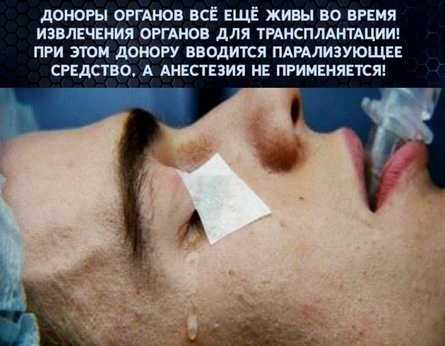 В России могут ввести презумпцию согласия на посмертное донорство