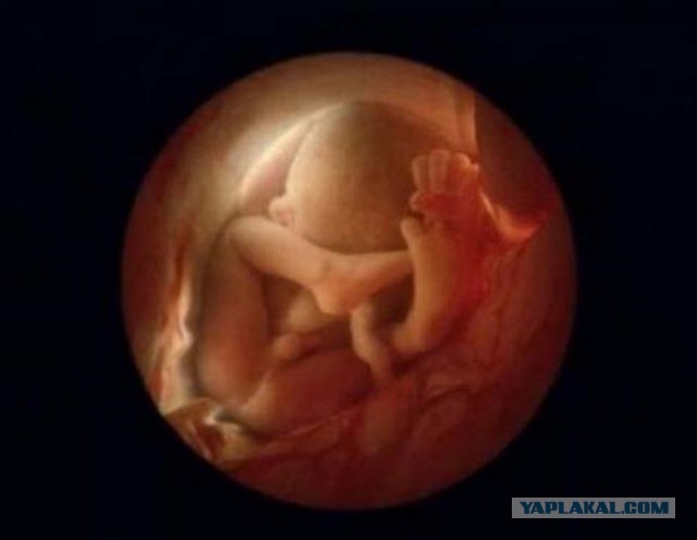 Начало жизни: от зачатия до рождения (24 фото)