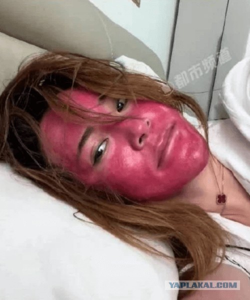 Женщина, 22 года не снимавшая макияж, осталась с красно-фиолетовым лицом