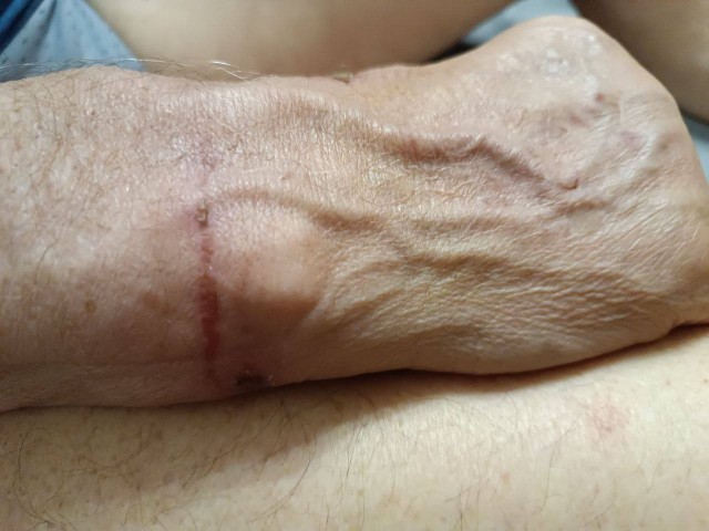 78-летнего дедушку с альцгеймером жестоко травмировали в частном подмосковном доме престарелых