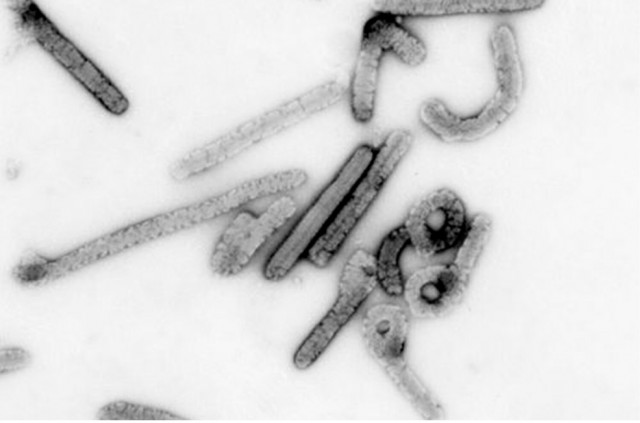 Эфиопия сообщила о первой вспышке марбургской лихорадки
