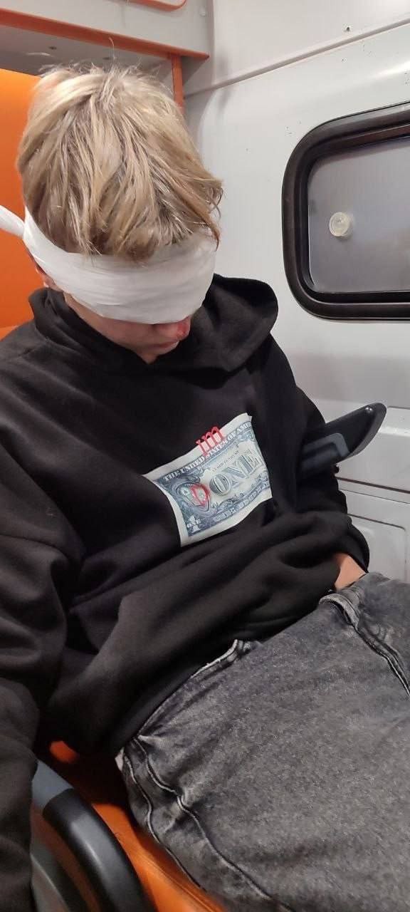 В Челябинске подросток выстрелил школьнику в лицо из ракетницы