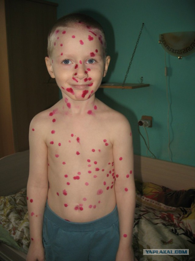 Проще было бы валиком закатать