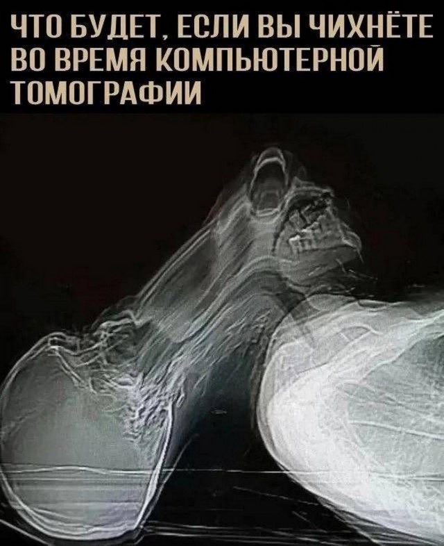 Всего понемногу. От 01.03.2025