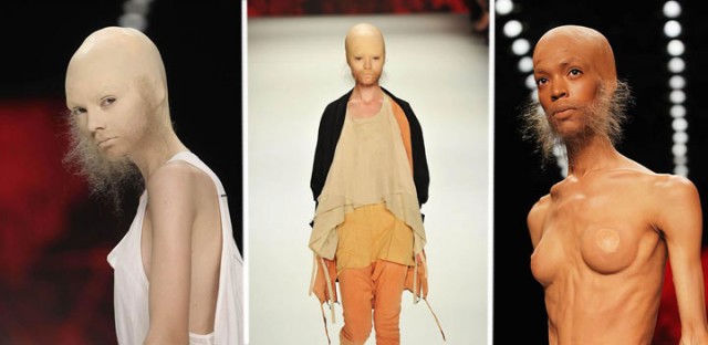 Как я ослеп