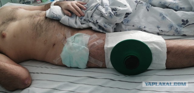 Интересные факты из истории зелёнки