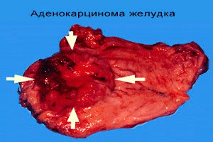 Последствия Фукусимы в Тихом океане