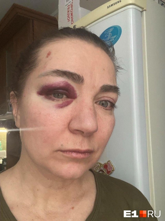 «Убивай ее!»: Жену экс-полицейского жёстко избили в Екатеринбурге