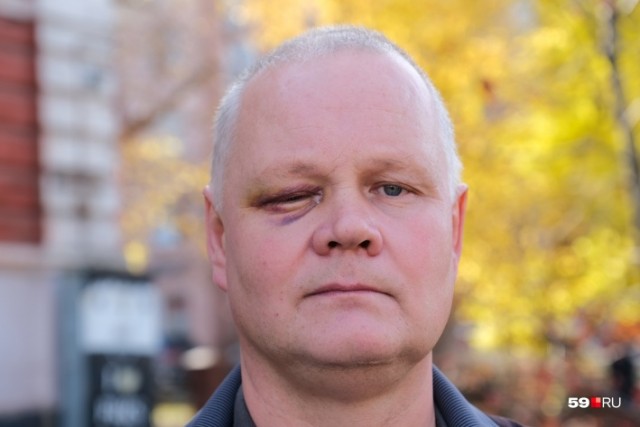 «Схватил стул и ударил меня в глаз»: пермский спасатель обвинил начальство в избиении