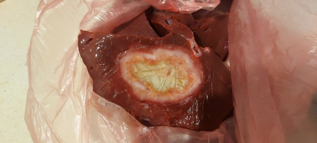 О борьбе с туберкулезом