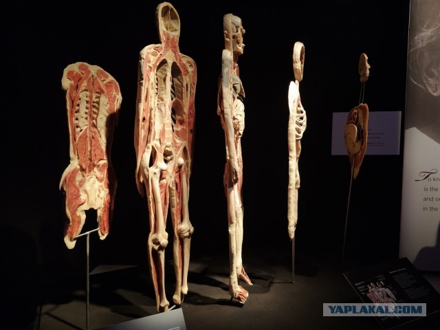 Посетил выставку Body Worlds на ВДНХ