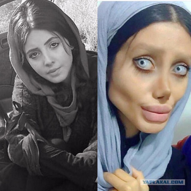 Иранка сделала 50 операций, чтобы быть похожей на Анджелину Джоли