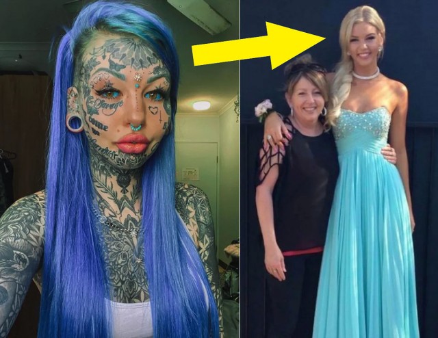 Три стадии психического заболевания