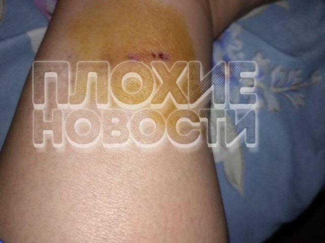 Жуткие кадры: В Хабаровске бродячие собаки едва не растерзали девушку