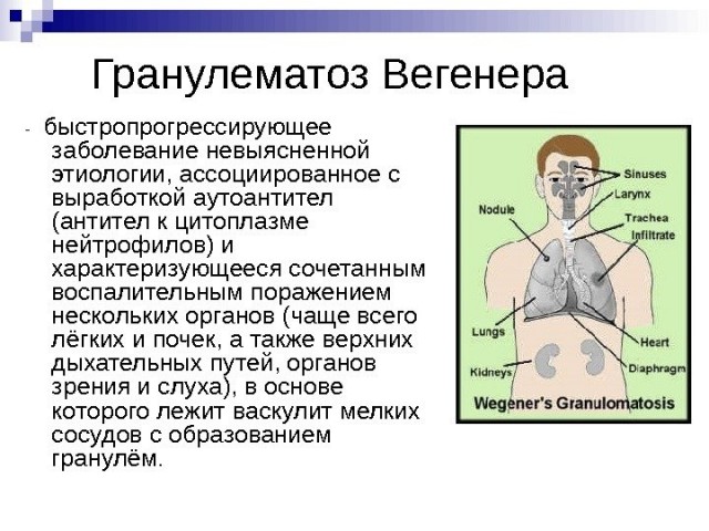 У москвички разрушился нос после того, как она постоянно в нем ковырялась