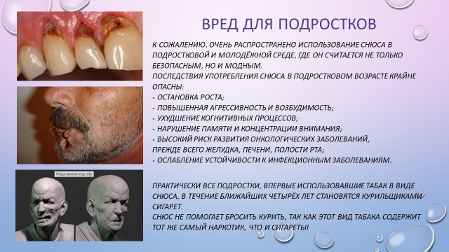 Закинула снюс и померла