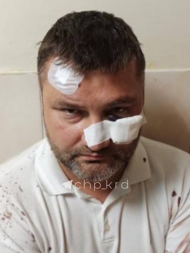 В Краснодаре депутат-коммерсант припугнул конкурентов, заказав нападение на их сотрудника!