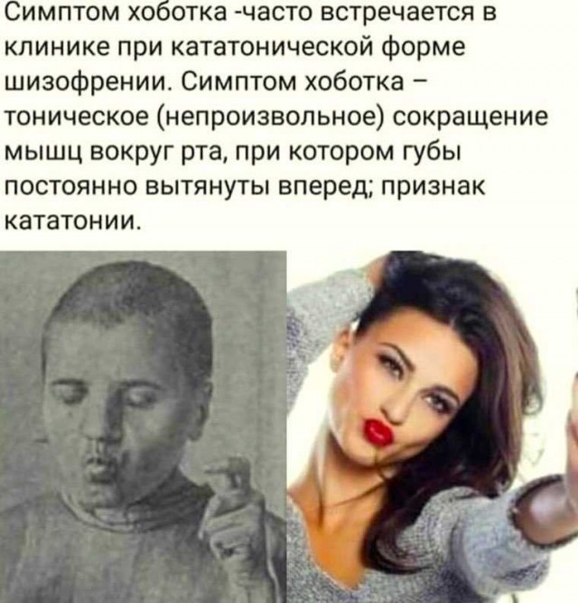 Половина мужчин откажутся от свидания с девушкой, увеличившей губы