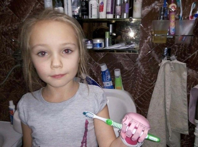 Протезы для детей