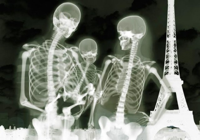14 рентгеновских фотографий которые