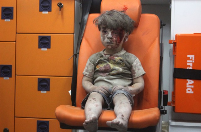 Раненый мальчик в Алепо