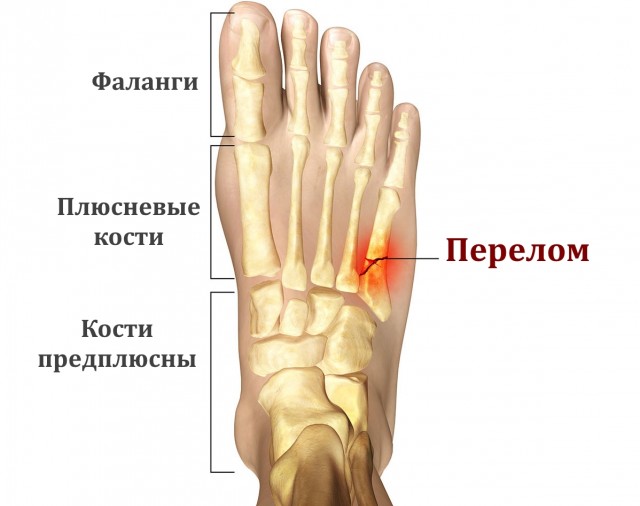 Мысли травматолога