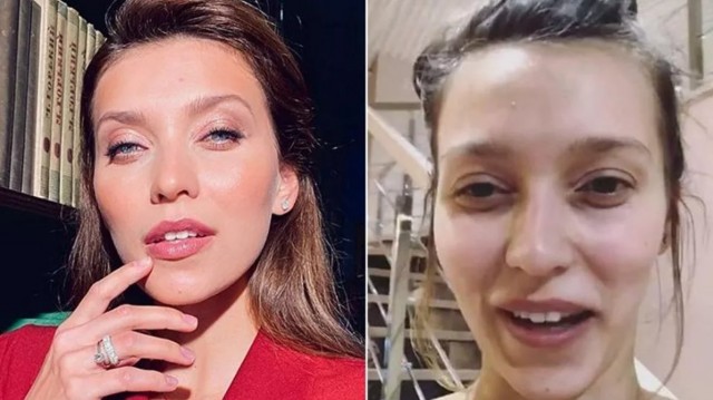 Тодоренко регина фото до и после пластики